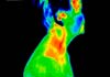 Click for more details about Medical Thermal Imaging