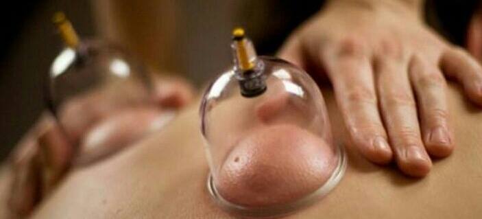 Profile picture for The Cupping Clinic
