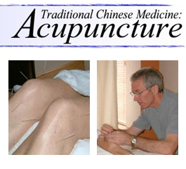 Profile picture for Upminster Acupuncture