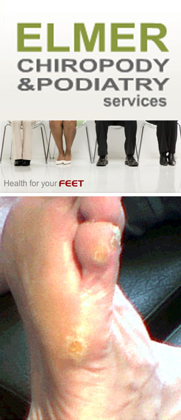 Profile picture for Elmer Chiropodists & Podiatrist Services