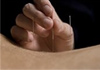 Thumbnail picture for Victoria Johnson Acupuncture DipAc MBAcC