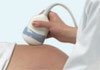 Thumbnail picture for Babybond Maternity Services