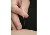 Thumbnail picture for Woodlands Acupuncture